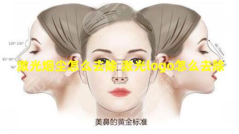 激光烟尘怎么去除 激光logo怎么去除